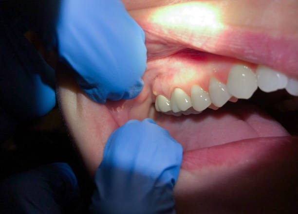 Best Emergency Cosmetic Dentistry (e.g., broken veneers) in Grand Ledge, MI